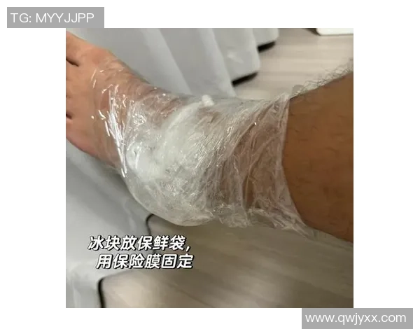 打篮球时腿部扭伤后的应急处理与恢复建议分享